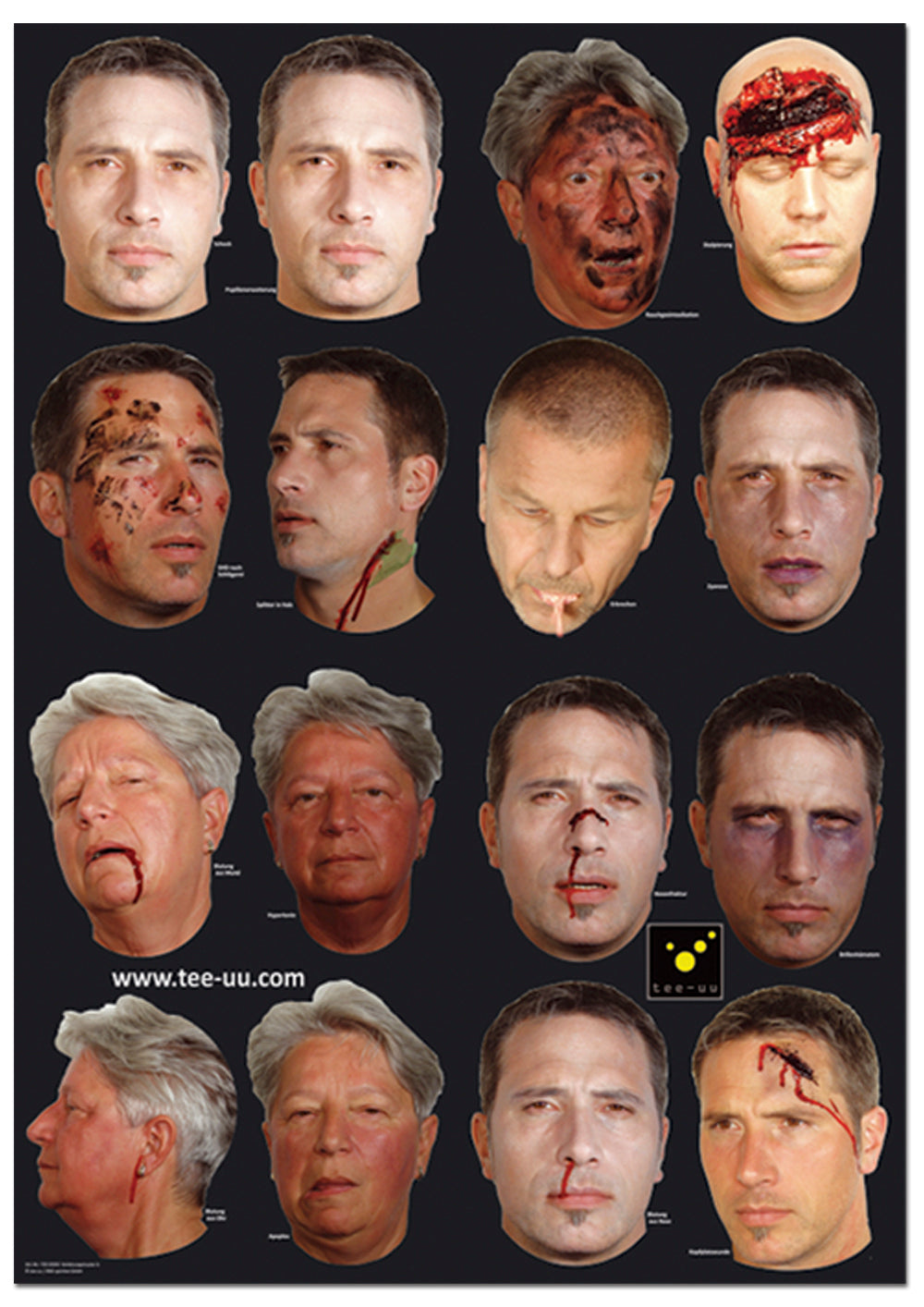 Pattern of Injuries for CRASH & CARRY Mannequin