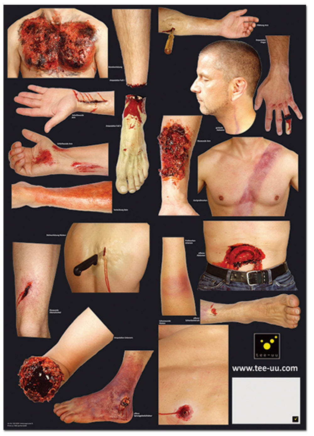 Pattern of Injuries for CRASH & CARRY Mannequin
