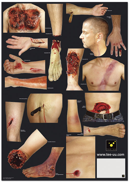 Pattern of Injuries for CRASH & CARRY Mannequin